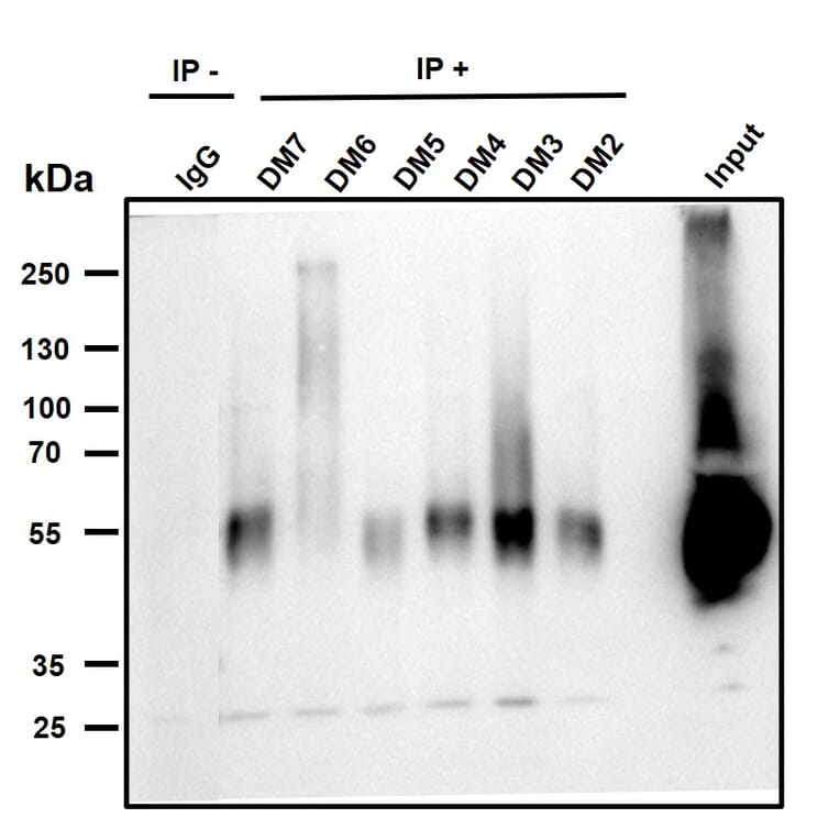 Immunoprecipitation - Anti-BCMA Antibody [DM4] - BSA and Azide free (A318679) - Antibodies.com