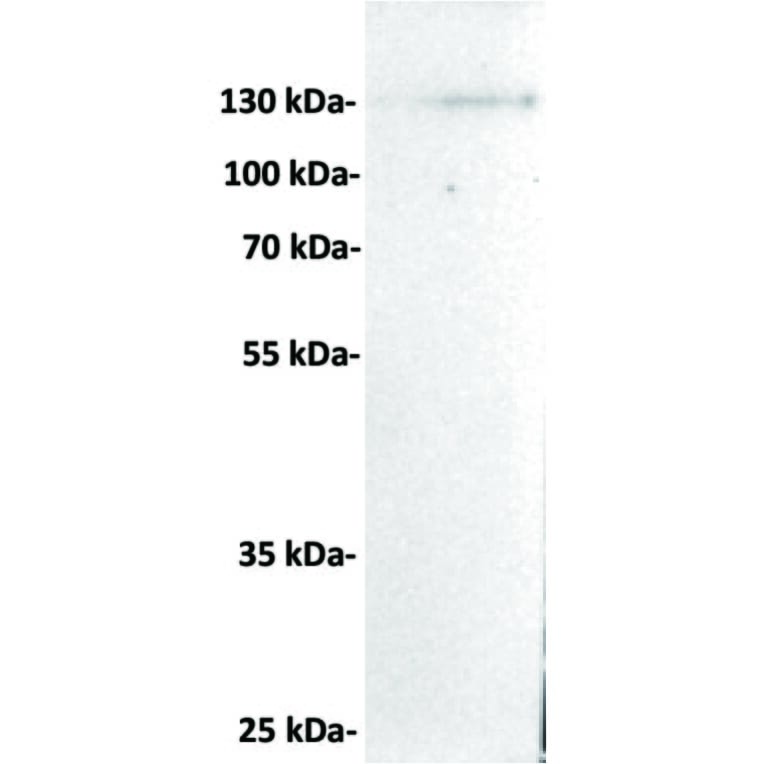 Western Blot - Anti-CD21 Antibody [DMC280] - BSA and Azide free (A318778) - Antibodies.com