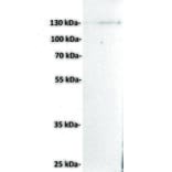 Western Blot - Anti-CD21 Antibody [DMC280] - BSA and Azide free (A318778) - Antibodies.com