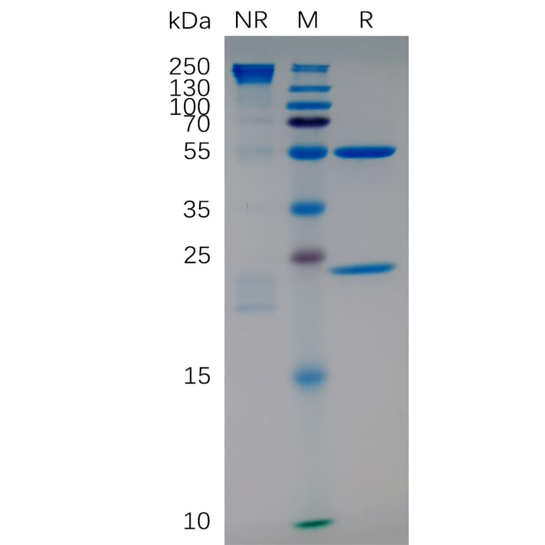 SDS-PAGE - Anti-Integrin alpha 4/CD49D Humanized Antibody [Natalizumab Biosimilar] - Azide free (A318888) - Antibodies.com