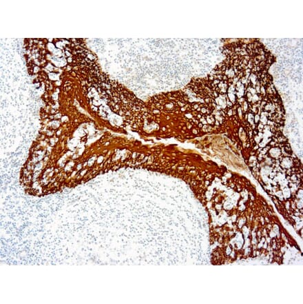 Immunohistochemistry - DAB Substrate (Stable) Kit (A319569) - Antibodies.com