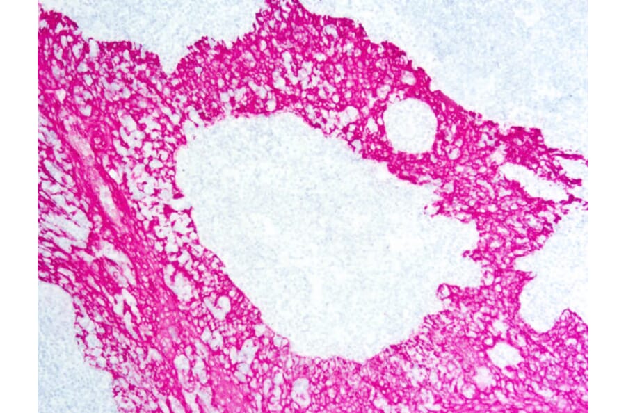 Immunohistochemistry - Alkaline Phosphatase (AP) Chromogen - Red Kit (A319571) - Antibodies.com