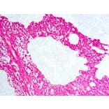 Immunohistochemistry - Alkaline Phosphatase (AP) Chromogen - Red Kit (A319571) - Antibodies.com