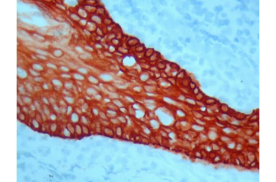 Immunohistochemistry - Mono AEC/Plus (A319572) - Antibodies.com