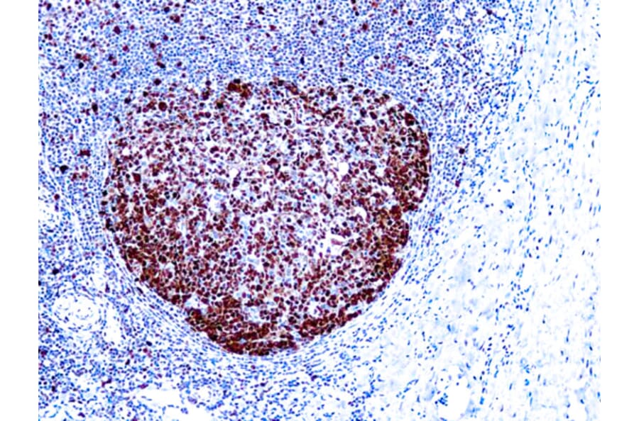 Immunohistochemistry - High Contrast DAB Kit (A319575) - Antibodies.com