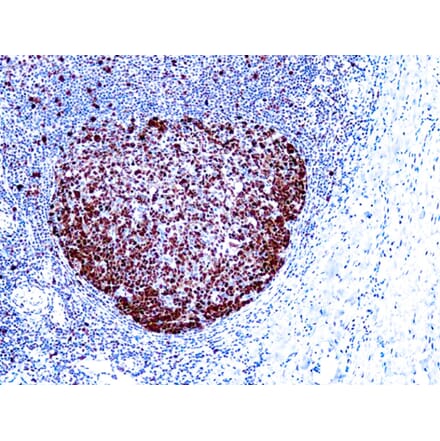 Immunohistochemistry - High Contrast DAB Kit (A319575) - Antibodies.com