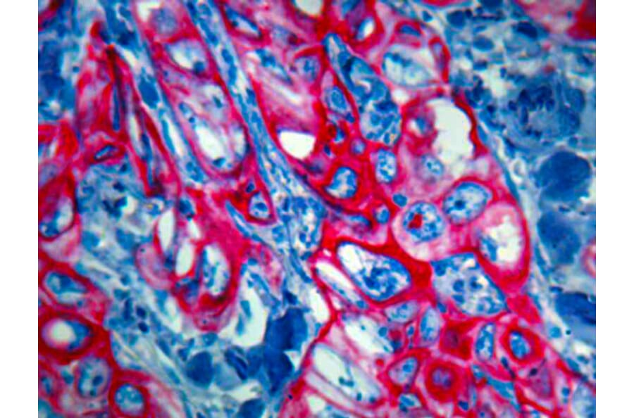 Immunohistochemistry - Alkaline Phosphatase (AP) Chromogen - Red (Auto, Enhanced) Kit (A319577) - Antibodies.com