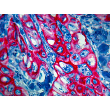 Immunohistochemistry - Alkaline Phosphatase (AP) Chromogen - Red (Auto, Enhanced) Kit (A319577) - Antibodies.com