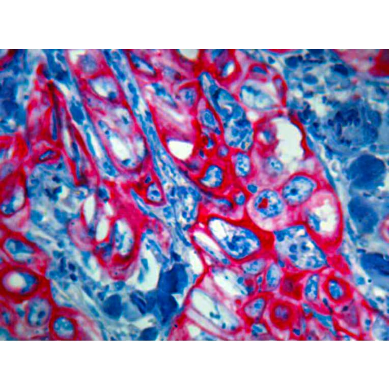 Immunohistochemistry - Alkaline Phosphatase (AP) Chromogen - Red (Auto, Enhanced) Kit (A319577) - Antibodies.com