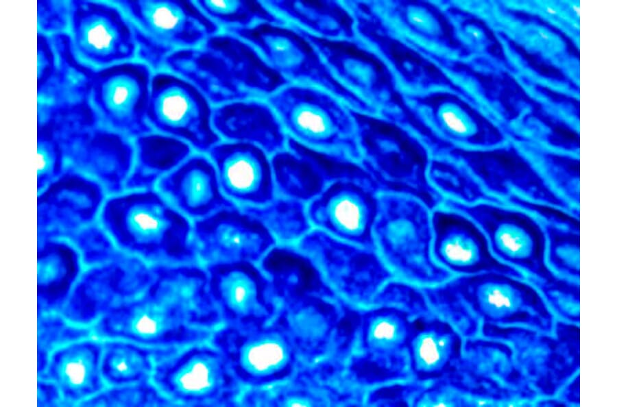 Immunohistochemistry - Alkaline Phosphatase (AP) Chromogen - Blue Enhanced Kit (A319578) - Antibodies.com