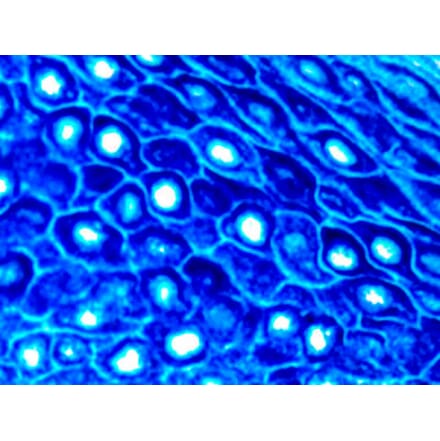 Immunohistochemistry - Alkaline Phosphatase (AP) Chromogen - Blue Enhanced Kit (A319578) - Antibodies.com