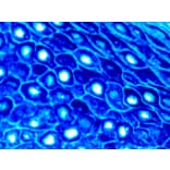 Immunohistochemistry - Alkaline Phosphatase (AP) Chromogen - Blue Enhanced Kit (A319578) - Antibodies.com