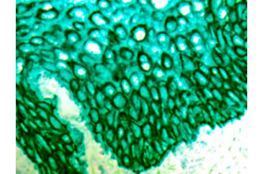 Immunohistochemistry - Alkaline Phosphatase (AP) Chromogen - Green Enhanced Kit (A319579) - Antibodies.com