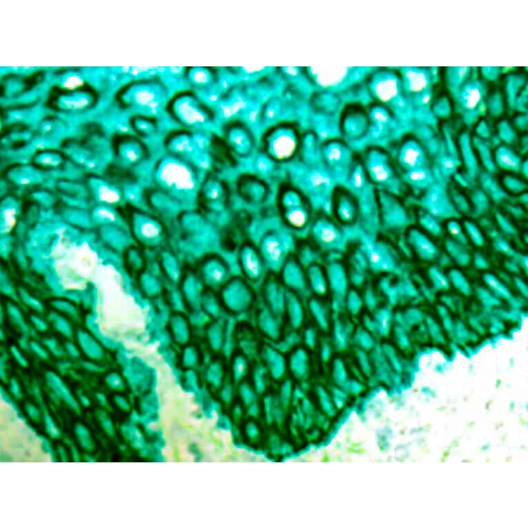 Immunohistochemistry - Alkaline Phosphatase (AP) Chromogen - Green Enhanced Kit (A319579) - Antibodies.com