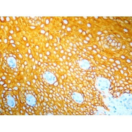 Immunohistochemistry - HRP Chromogen - Yellow Kit (A319580) - Antibodies.com