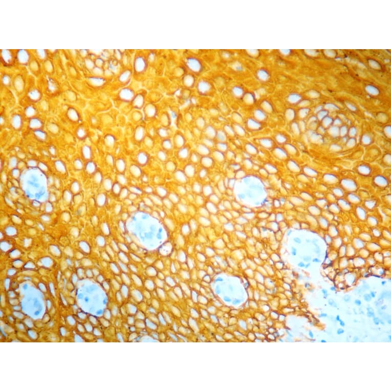 Immunohistochemistry - HRP Chromogen - Yellow Kit (A319580) - Antibodies.com