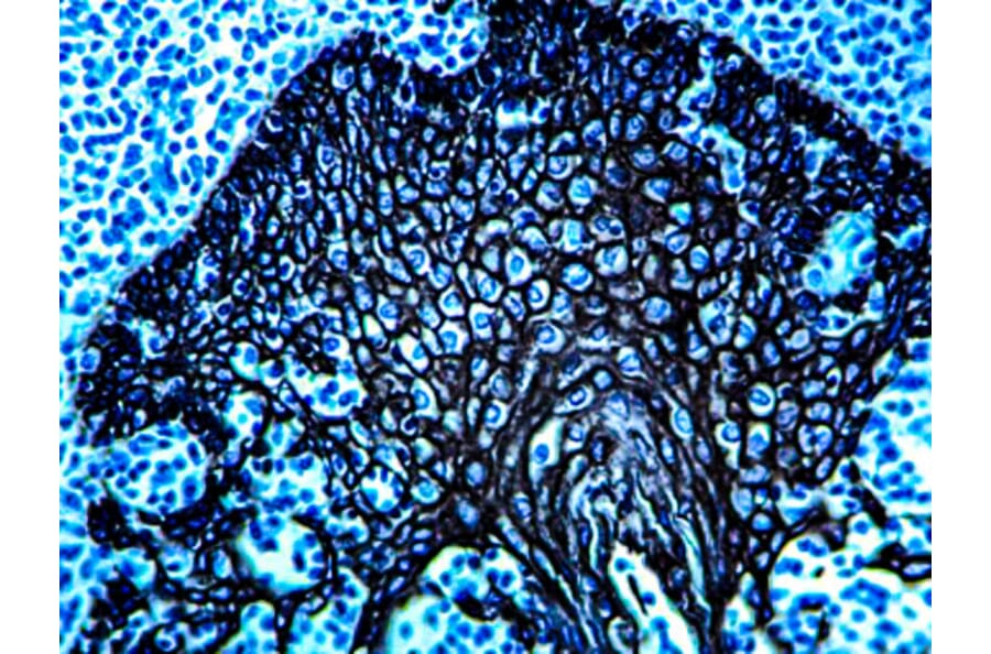 Immunohistochemistry - HRP Chromogen - Black Kit (A319581) - Antibodies.com