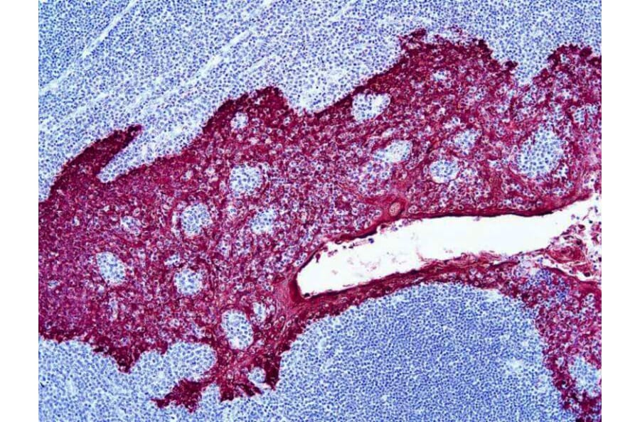 Immunohistochemistry - HRP Chromogen - Red Kit (A319587) - Antibodies.com