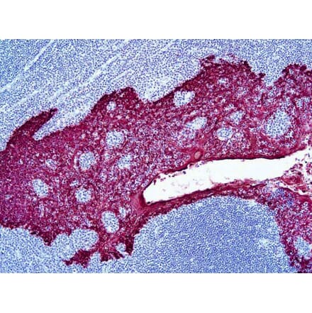 Immunohistochemistry - HRP Chromogen - Red Kit (A319587) - Antibodies.com