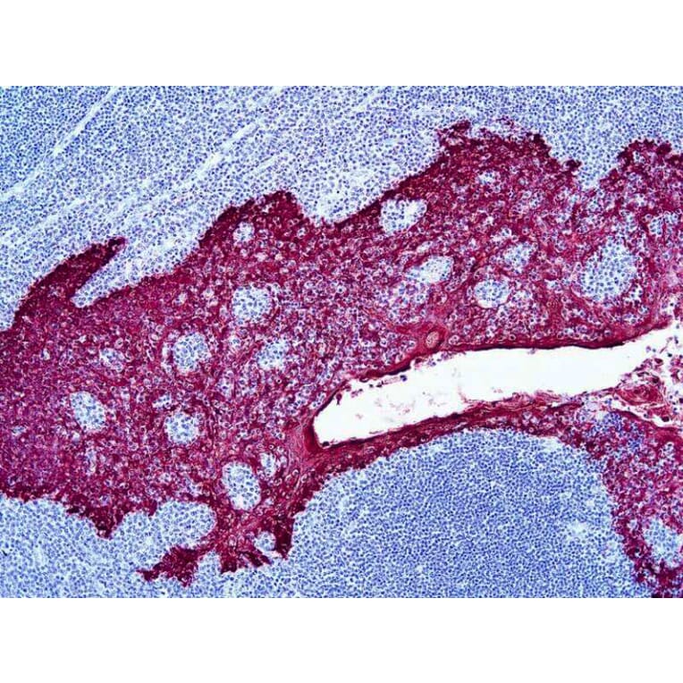 Immunohistochemistry - HRP Chromogen - Red Kit (A319587) - Antibodies.com