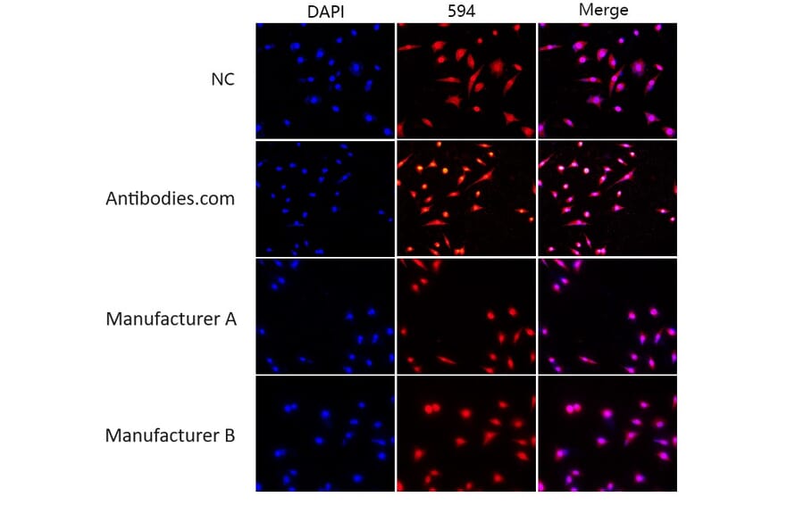 Immunocytochemistry - Enhanced Antifade Mounting Medium (A319608) - Antibodies.com