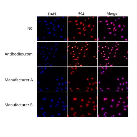 Immunocytochemistry - Enhanced Antifade Mounting Medium (A319608) - Antibodies.com