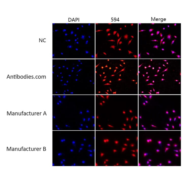 Enhanced Antifade Mounting Medium (A319608)