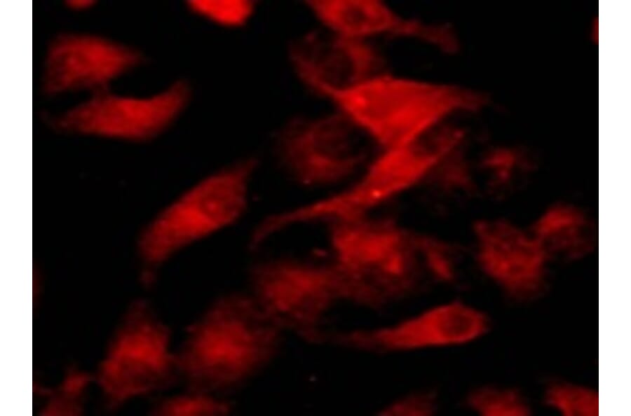 Immunocytochemistry - Cell Plasma Membrane Staining Kit (Orange Fluorescence) (A319611) - Antibodies.com