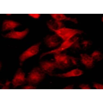 Immunocytochemistry - Cell Plasma Membrane Staining Kit (Orange Fluorescence) (A319611) - Antibodies.com