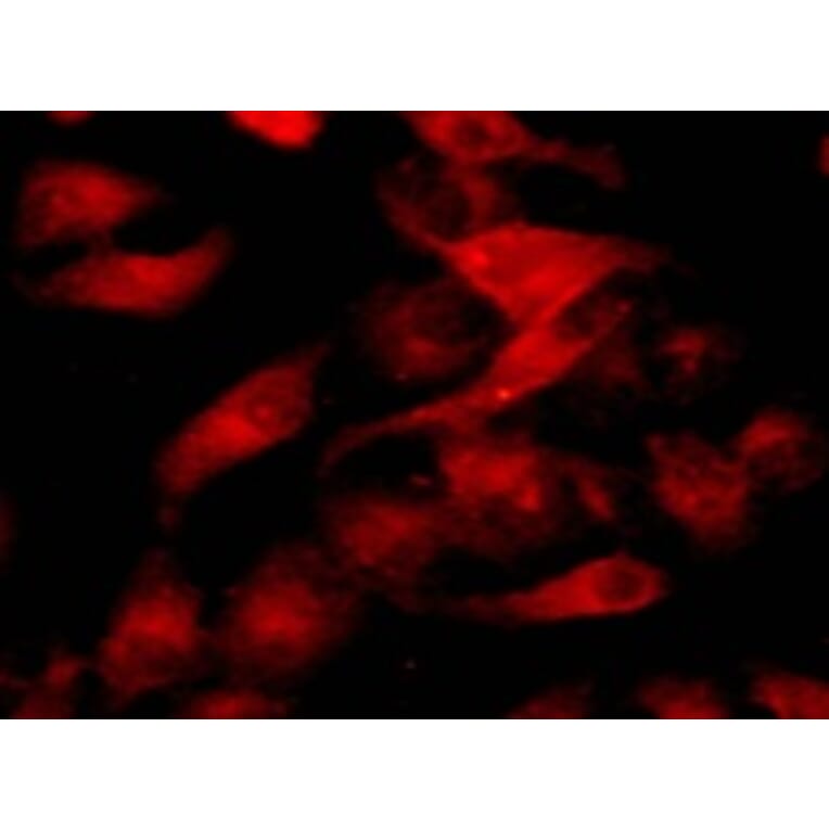 Immunocytochemistry - Cell Plasma Membrane Staining Kit (Orange Fluorescence) (A319611) - Antibodies.com