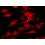 Immunocytochemistry - Cell Plasma Membrane Staining Kit (Orange Fluorescence) (A319611) - Antibodies.com