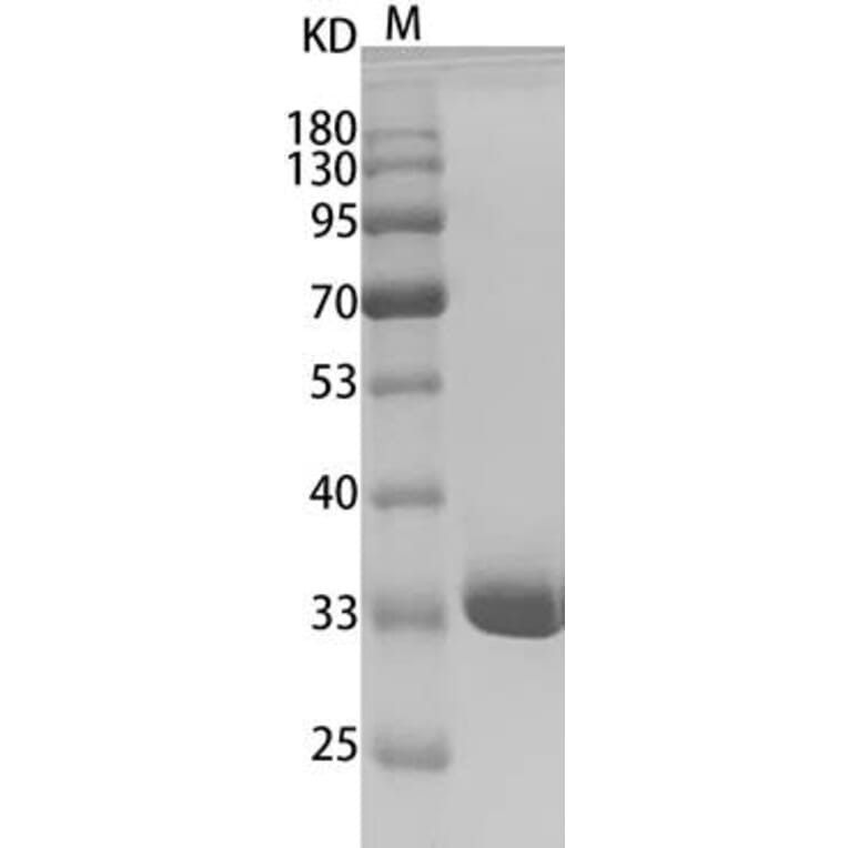 SDS-PAGE - Recombinant Human Annexin V / ANXA5 Protein (Functional) (A319647) - Antibodies.com