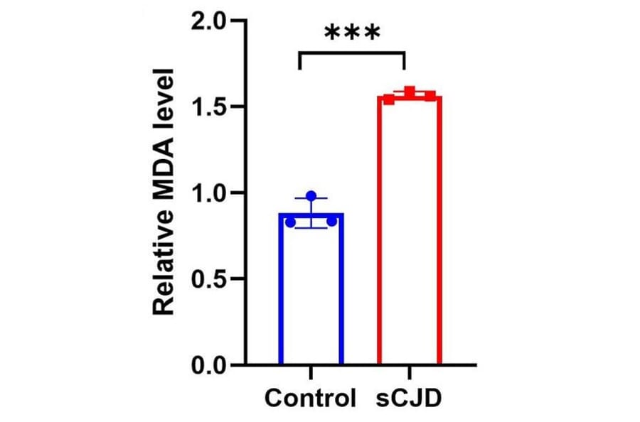 Lipid Peroxidation Assay - Lipid Peroxidation Assay Kit (A319696) - Antibodies.com