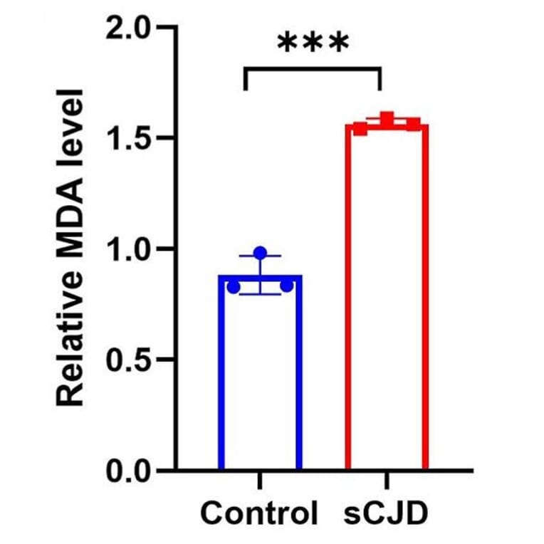 Lipid Peroxidation Assay - Lipid Peroxidation Assay Kit (A319696) - Antibodies.com