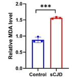 Lipid Peroxidation Assay - Lipid Peroxidation Assay Kit (A319696) - Antibodies.com