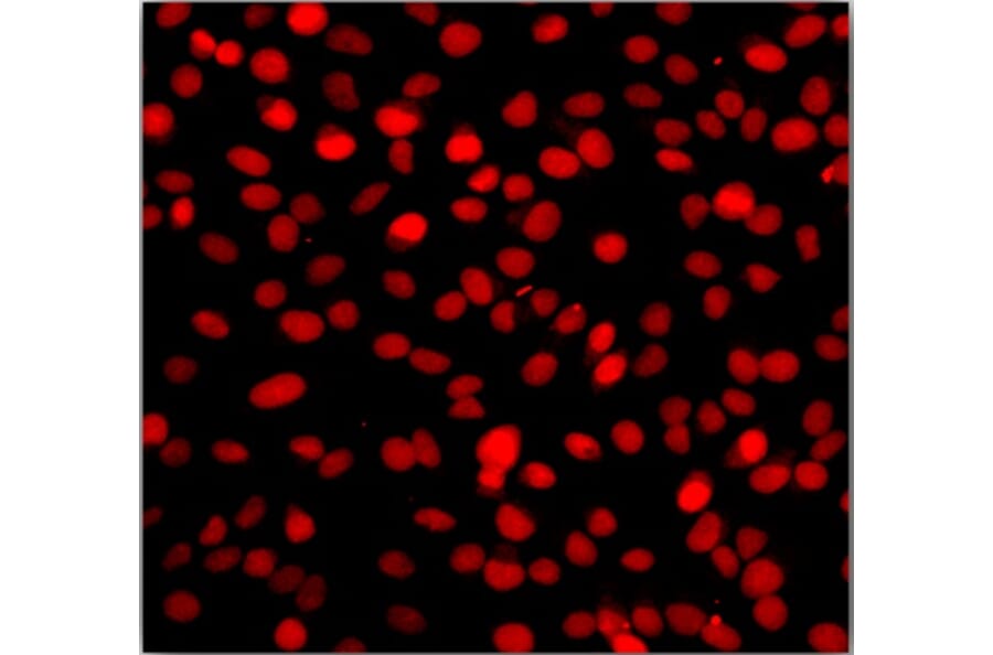 Immunocytochemistry - One-step TUNEL Apoptosis Assay Kit (Orange Fluorescence) (A319768) - Antibodies.com
