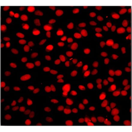 Immunocytochemistry - One-step TUNEL Apoptosis Assay Kit (Orange Fluorescence) (A319768) - Antibodies.com