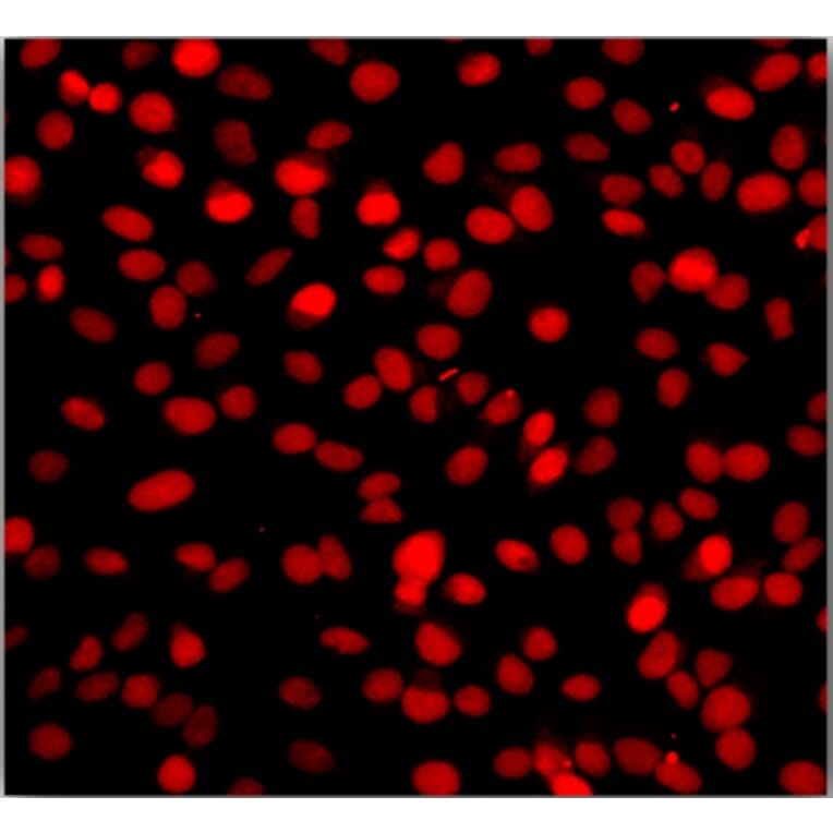 Immunocytochemistry - One-step TUNEL Apoptosis Assay Kit (Orange Fluorescence) (A319768) - Antibodies.com