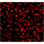 Immunocytochemistry - One-step TUNEL Apoptosis Assay Kit (Orange Fluorescence) (A319768) - Antibodies.com