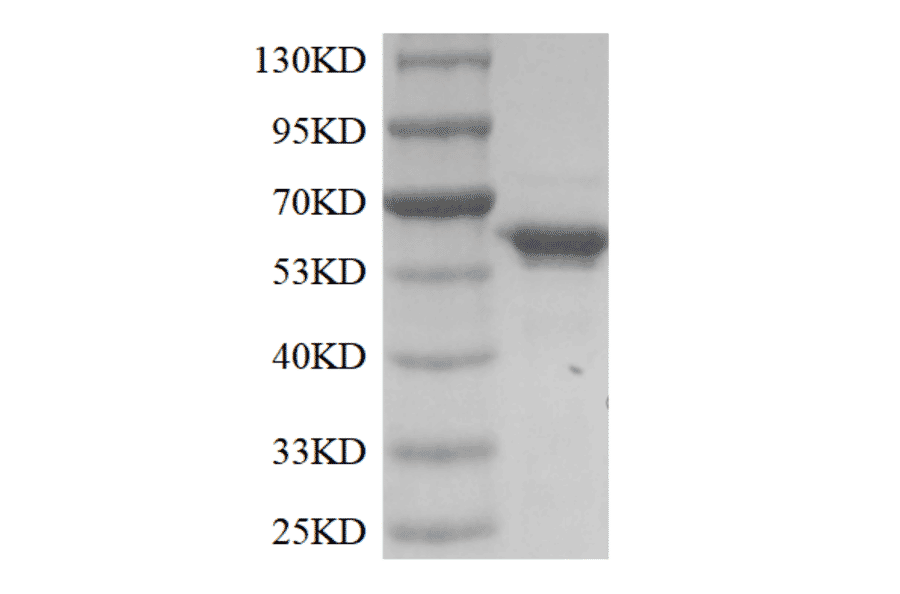 SDS-PAGE - Recombinant Terminal Deoxynucleotidyl Transferase / TdT Protein (Functional) (A319774) - Antibodies.com