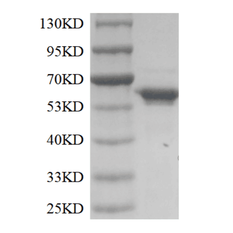 SDS-PAGE - Recombinant Terminal Deoxynucleotidyl Transferase / TdT Protein (Functional) (A319774) - Antibodies.com
