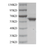 SDS-PAGE - Recombinant Terminal Deoxynucleotidyl Transferase / TdT Protein (Functional) (A319774) - Antibodies.com