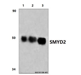 Anti-SMYD2 (L148) Antibody from Bioworld Technology (BS9025) - Antibodies.com