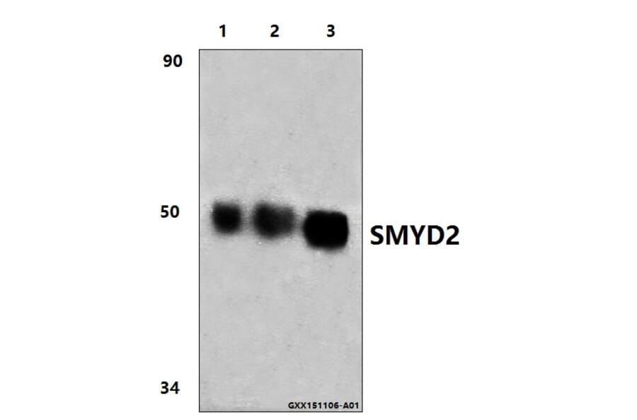 Anti-SMYD2 (L148) Antibody from Bioworld Technology (BS9025) - Antibodies.com