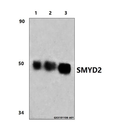 Anti-SMYD2 (L148) Antibody from Bioworld Technology (BS9025) - Antibodies.com
