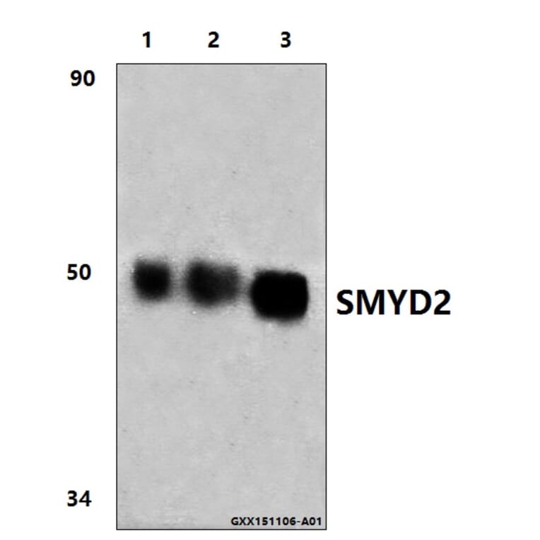Anti-SMYD2 (L148) Antibody from Bioworld Technology (BS9025) - Antibodies.com