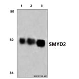 Anti-SMYD2 (L148) Antibody from Bioworld Technology (BS9025) - Antibodies.com
