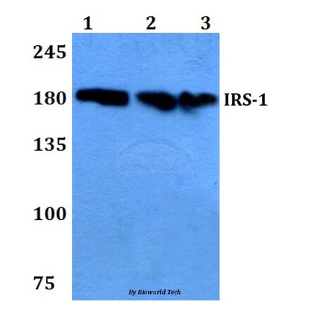Anti-IRS-1 (D606) Antibody from Bioworld Technology (BS9113) - Antibodies.com
