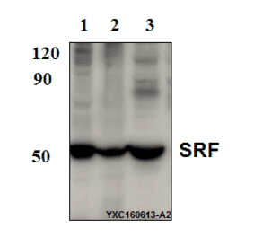 Anti-SRF (N153) Antibody from Bioworld Technology (BS9121) - Antibodies.com