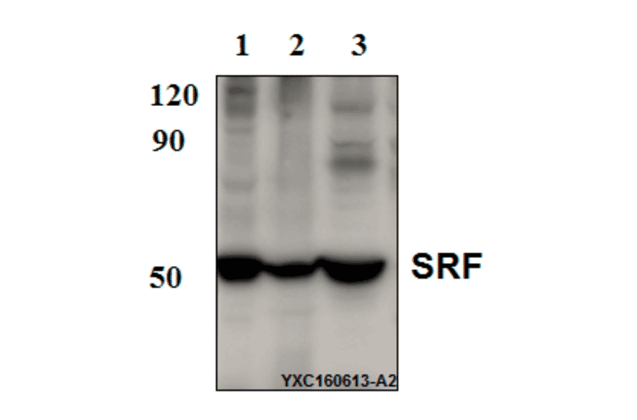 Anti-SRF (N153) Antibody from Bioworld Technology (BS9121) - Antibodies.com